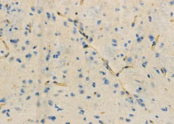Anti-KDELR2 antibody used in IHC (Paraffin sections) (IHC-P). GTX05062