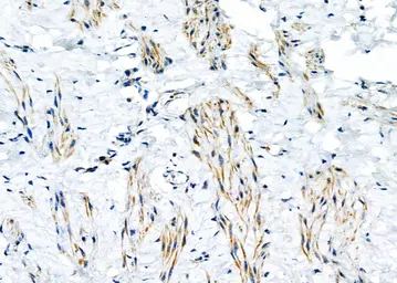 Anti-KDELR2 antibody used in IHC (Paraffin sections) (IHC-P). GTX05062