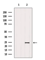 Anti-KDELR2 antibody used in Western Blot (WB). GTX05062