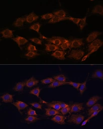 Anti-MT-ND1 antibody used in Immunocytochemistry/ Immunofluorescence (ICC/IF). GTX05066