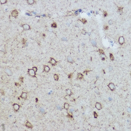 Anti-MTCO2 antibody used in IHC (Paraffin sections) (IHC-P). GTX05069