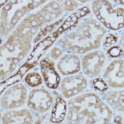 Anti-MTCO2 antibody used in IHC (Paraffin sections) (IHC-P). GTX05069