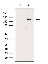 Anti-FAK (phospho Tyr861) antibody used in Western Blot (WB). GTX05090