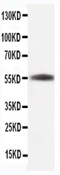 Anti-beta Tubulin antibody [TUB 2.1] used in Western Blot (WB). GTX05098