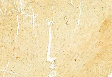 Anti-NLRP3 antibody used in IHC (Paraffin sections) (IHC-P). GTX05106