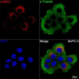 Anti-Laminin gamma 2 antibody used in Immunocytochemistry/ Immunofluorescence (ICC/IF). GTX05125
