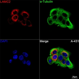 Anti-Laminin gamma 2 antibody used in Immunocytochemistry/ Immunofluorescence (ICC/IF). GTX05125