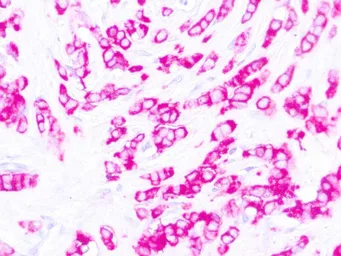 Anti-MUC1 antibody [E29] (ready-to-use) used in IHC (Paraffin sections) (IHC-P). GTX05135