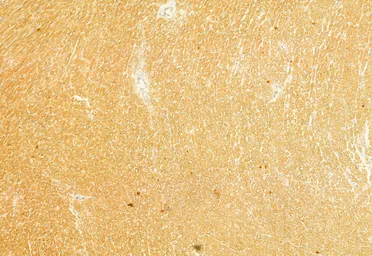 Anti-FIS1 antibody used in IHC (Paraffin sections) (IHC-P). GTX05149