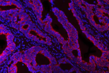 Anti-HBEGF antibody used in IHC (Paraffin sections) (IHC-P). GTX05154