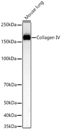 Anti-Collagen IV antibody [ARC62585] used in Western Blot (WB). GTX05165