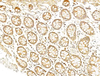 Anti-p70 S6K (phospho Thr389/Thr412) antibody used in IHC (Paraffin sections) (IHC-P). GTX05173
