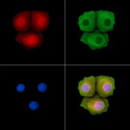 Anti-FANCD2 (phospho Ser222) antibody used in Immunocytochemistry/ Immunofluorescence (ICC/IF). GTX05195