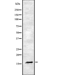Anti-RAMP1 antibody used in Western Blot (WB). GTX05199