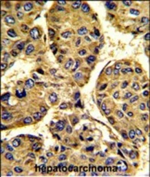 Anti-Asporin antibody used in IHC (Paraffin sections) (IHC-P). GTX05210