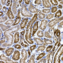 Anti-BNP / proBNP antibody used in IHC (Paraffin sections) (IHC-P). GTX05212