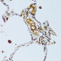Anti-C1qC antibody used in IHC (Paraffin sections) (IHC-P). GTX05218