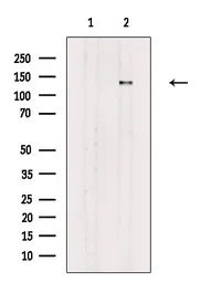 Anti-PER2 (phospho Ser662) antibody used in Western Blot (WB). GTX05221