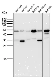 Anti-ATF4 antibody [HCI-1] used in Western Blot (WB). GTX05222