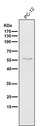 Anti-ATF4 antibody [HCI-1] used in Western Blot (WB). GTX05222