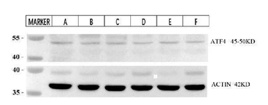 Anti-ATF4 antibody [HCI-1] used in Western Blot (WB). GTX05222