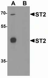 Anti-ST2 antibody used in Western Blot (WB). GTX05232
