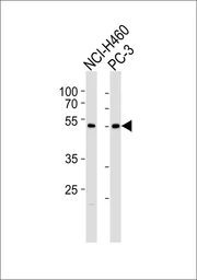 Anti-SLC39A9 antibody used in Western Blot (WB). GTX05235