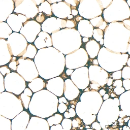 Anti-ATGL antibody [ARC80388] used in IHC (Paraffin sections) (IHC-P). GTX05269