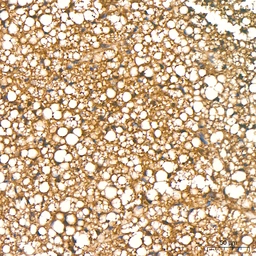 Anti-ATGL antibody [ARC80388] used in IHC (Paraffin sections) (IHC-P). GTX05269