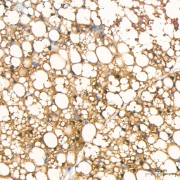 Anti-ATGL antibody [ARC80388] used in IHC (Paraffin sections) (IHC-P). GTX05269