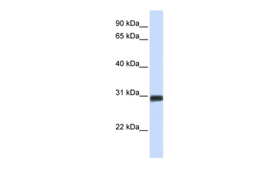 Anti-BARX2 antibody used in Western Blot (WB). GTX05270