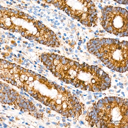Anti-ROMO1 antibody [ARC71752] used in IHC (Paraffin sections) (IHC-P). GTX05275