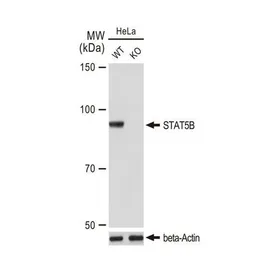 Anti-STAT5B antibody [GT1160] used in Western Blot (WB). GTX08967