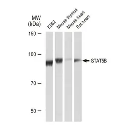 Anti-STAT5B antibody [GT1160] used in Western Blot (WB). GTX08967