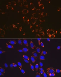 Anti-SOD2 antibody [GT1165] used in IHC (Paraffin sections) (IHC-P). GTX09013