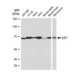 Anti-E2F1 antibody [GT1167] used in Western Blot (WB). GTX09015