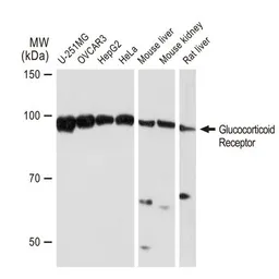 Anti-Glucocorticoid Receptor antibody [GT1170] used in Western Blot (WB). GTX09130