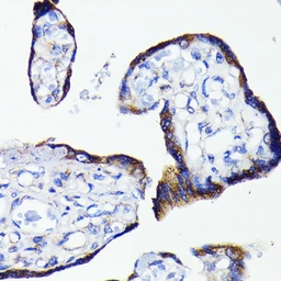 Anti-Bad antibody [GT1175] used in IHC (Paraffin sections) (IHC-P). GTX09508