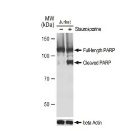 Anti-PARP antibody [GT1176] used in Western Blot (WB). GTX09509