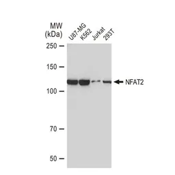 Anti-NFAT2 antibody [GT1177] used in Western Blot (WB). GTX09510