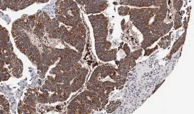 Anti-CXCR7 antibody [C1C2], Internal used in IHC (Paraffin sections) (IHC-P). GTX100027