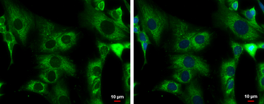 Anti-ACADM antibody used in Immunocytochemistry/ Immunofluorescence (ICC/IF). GTX100032