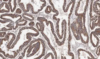 Anti-ACADM antibody used in IHC (Paraffin sections) (IHC-P). GTX100032