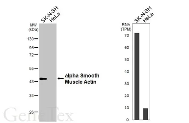 Anti-alpha Smooth Muscle Actin antibody used in Western Blot (WB). GTX100034