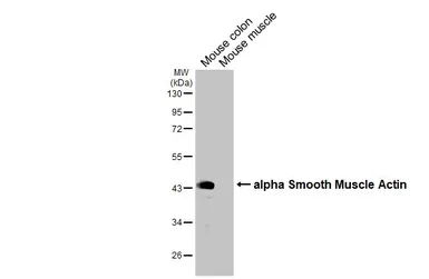 Anti-alpha Smooth Muscle Actin antibody used in Western Blot (WB). GTX100034
