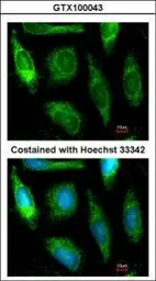 Anti-ALDH1A1 antibody [C3], C-term used in Immunocytochemistry/ Immunofluorescence (ICC/IF). GTX100043