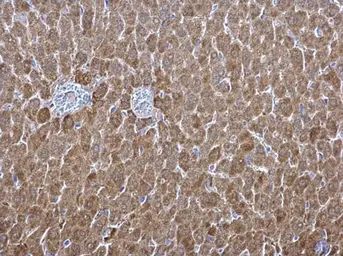 Anti-ALDH1A1 antibody [C3], C-term used in IHC (Paraffin sections) (IHC-P). GTX100043