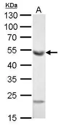 Anti-ALDH1A1 antibody [C3], C-term used in Western Blot (WB). GTX100043