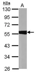 Anti-ALDH1A1 antibody [C3], C-term used in Western Blot (WB). GTX100043
