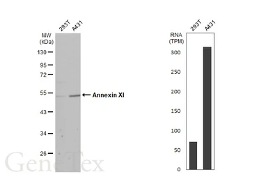 Anti-Annexin XI antibody used in Western Blot (WB). GTX100047